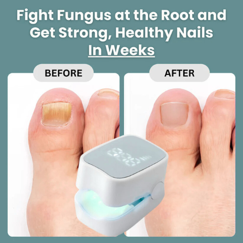 Shopnest™ - Nail Fungus Laser Device
