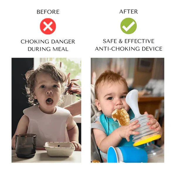 Shopnest™ ANTI-CHOKING DEVICE